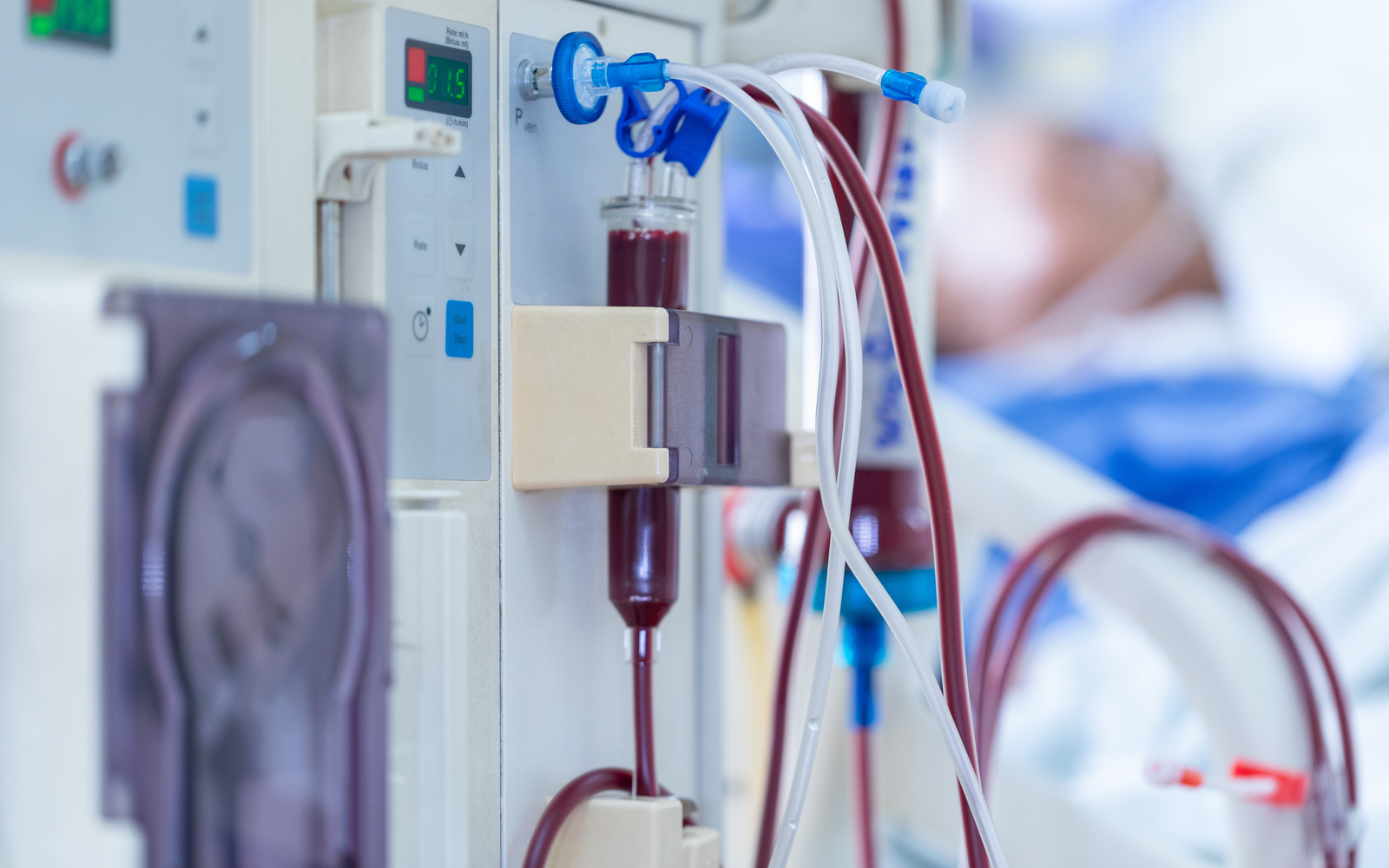 Dialysis Treatment