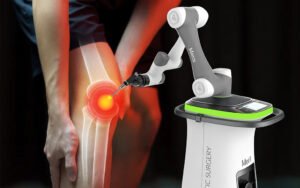 Robotic Total Knee Replacement Surgery 