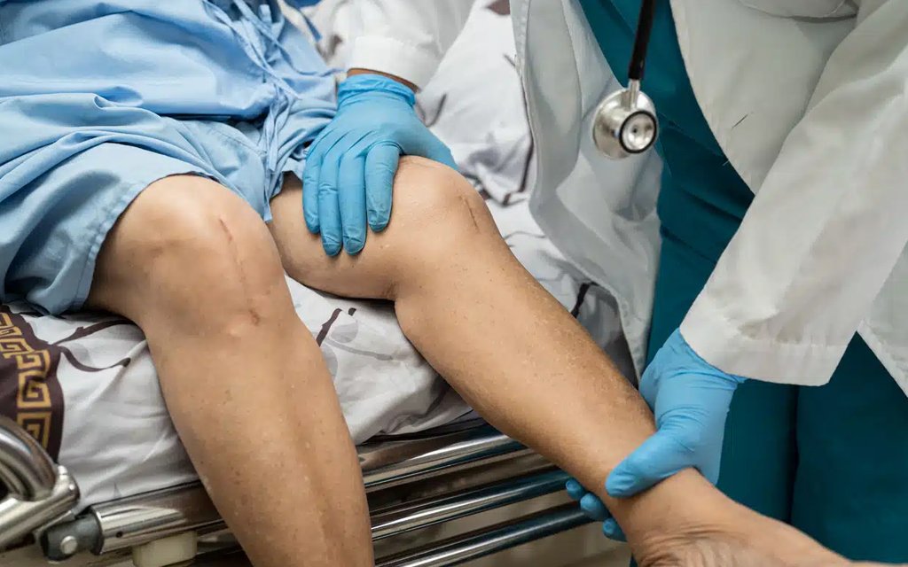 Knee Replacement Surgery Trichy