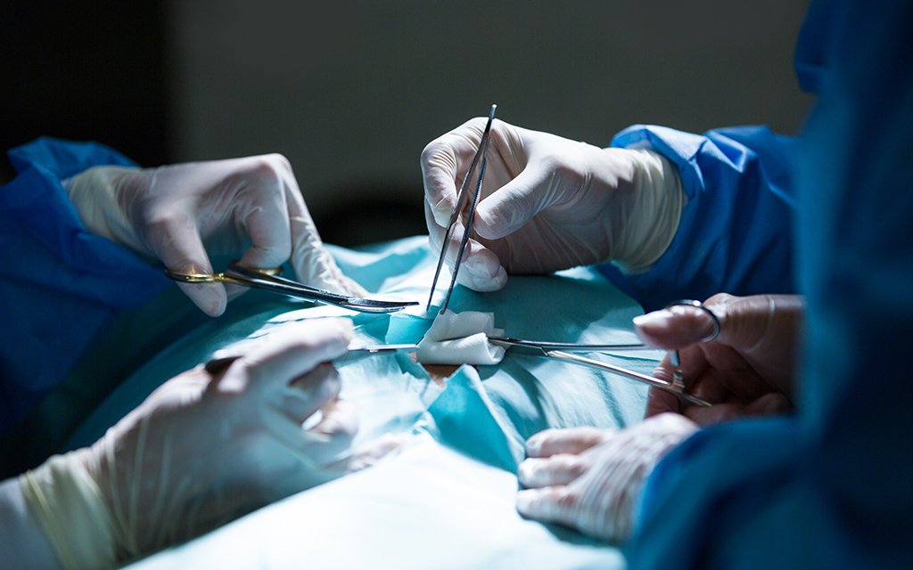 Best Heart Bypass Surgery Hospital In Namakkal