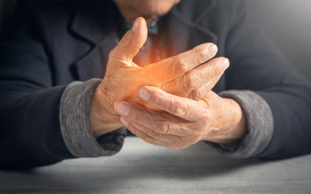Arthritis