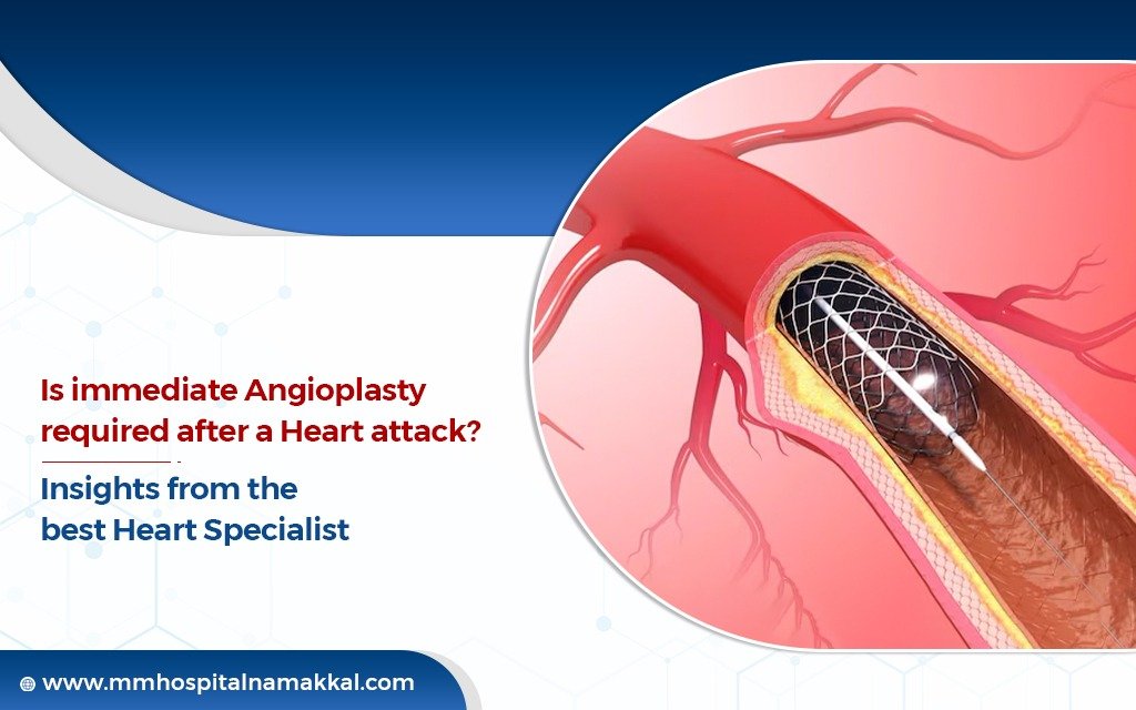 Is Immediate Angioplasty Required After a Heart Attack? Insights from the Best Heart Specialist