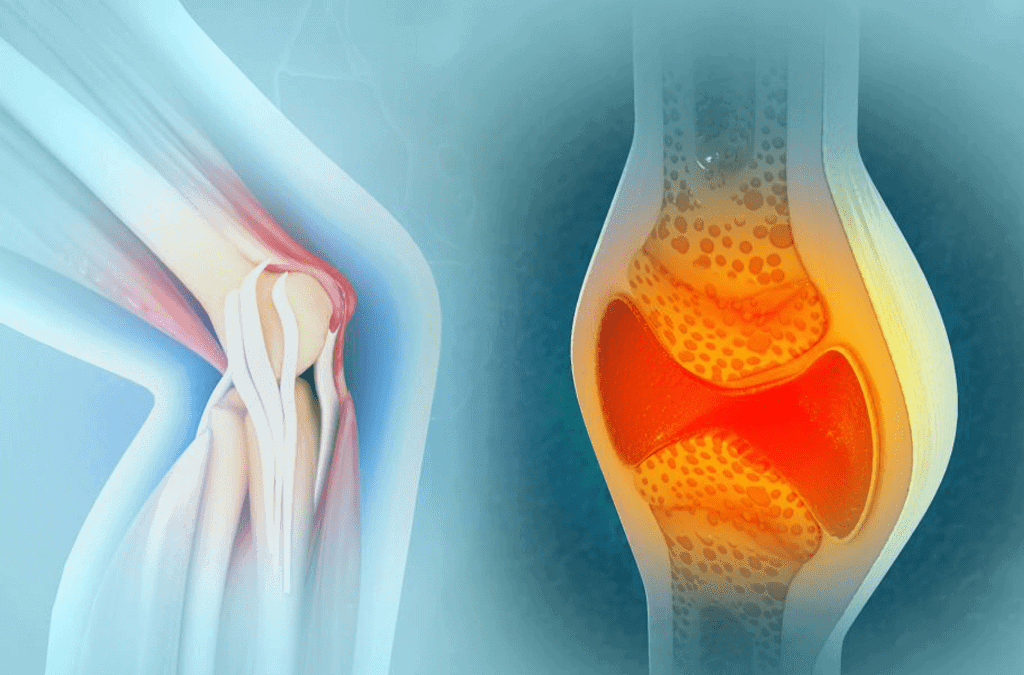 Do’s and Dont’s During Fractures and Spine Injuries