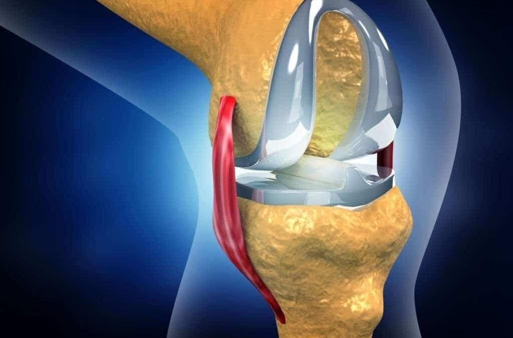 How Long It Take To Recover From Knee Replacement Surgery?