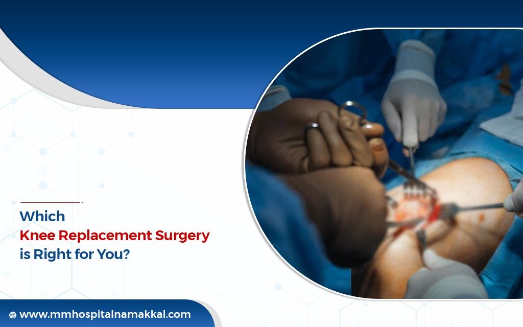 Which Knee Replacement Surgery Is Right for You? A Look at Indian Options