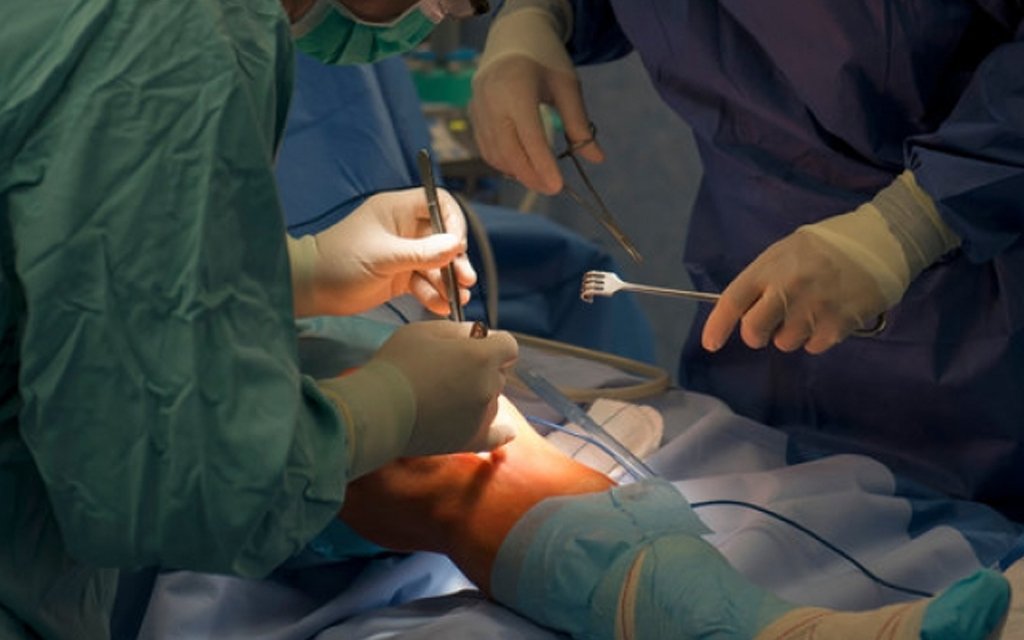traditional knee replacement 