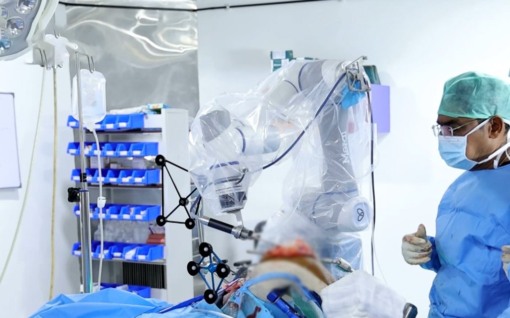 benefits of robotic-assisted knee replacement surgery
